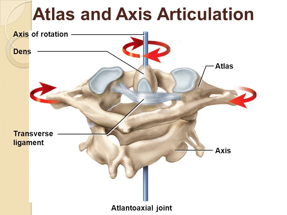 Atlas joint instability: Causes, consequences and solutions - MSK