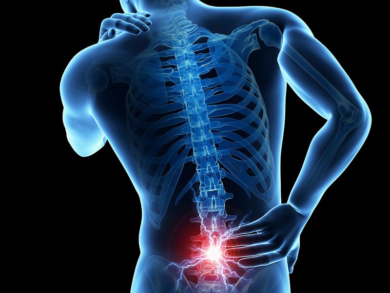 Lower back pain: Causes, treatment, and when to see a doctor