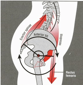 Intervertebral disc angles and the lumbar-sacral junction