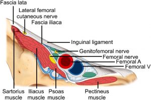 Pectineo-femoral pinch syndrome: A common cause of groin & anterior thigh  pain and weakness - MSK Neurology